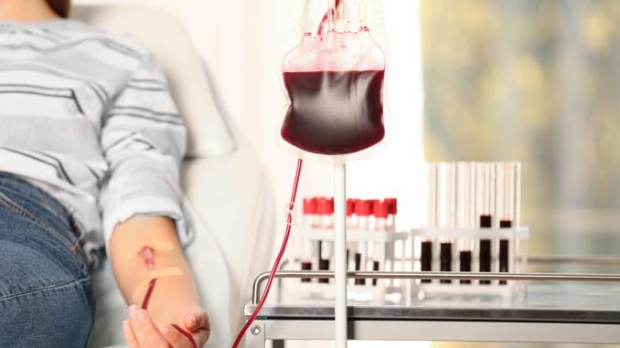Woman making blood donation at hospital, closeup. Blood may be bulked with dextran.