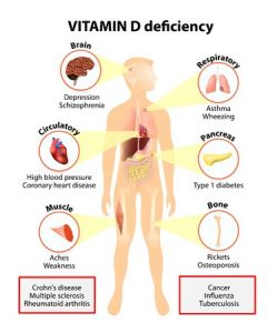 42801714 - vitamin d deficiency. symptoms and diseases caused by insufficient vitamin d. symptoms & signs. human silhouette with highlighted internal organs