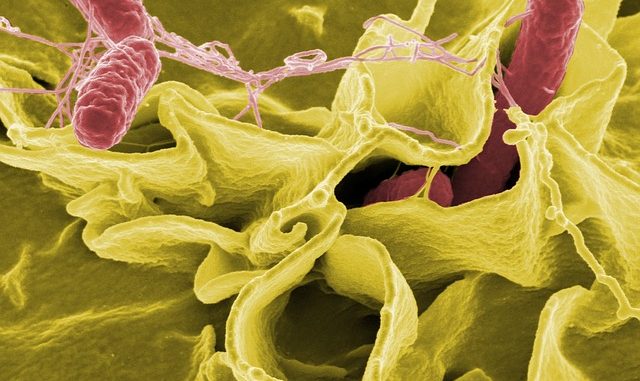 Salmonella - electronmicroscopic picture.