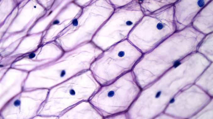 Onion plant cells are immobilized cell systems.