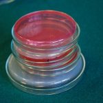 ISO 22196:2011 - a set of pour plates on a black background.