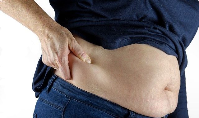 A woman exposing her visceral fat on her belly or stomach.