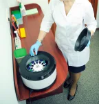 Plasmolifting. Preparation of the blood for injections. cosmetologist puts the tube of the blood in centrifuge for separation processing. downstream processing