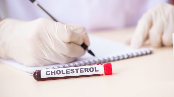 Tube of blood with cholesterol written on vial.